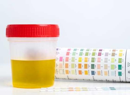 Сколько нужно урины для различных анализов мочи?