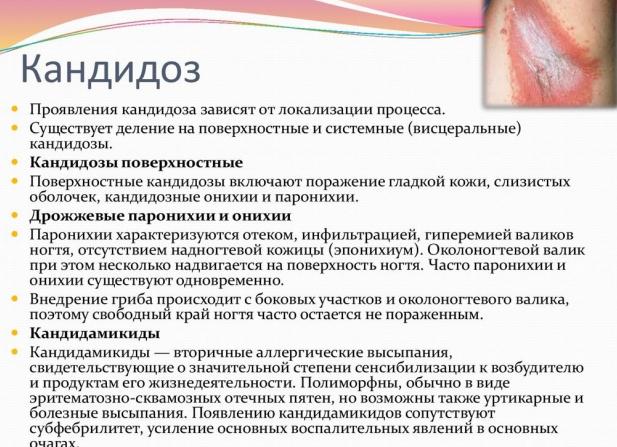 Какие признаки и чем лечить кандидоз у детей?