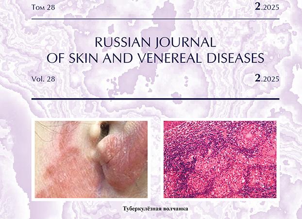 В каких случаях диагностируют третичный сифилис, и как его лечить?