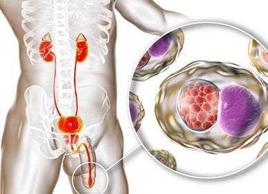 Какие симптомы хламидиоза, как проявляются первые признаки?