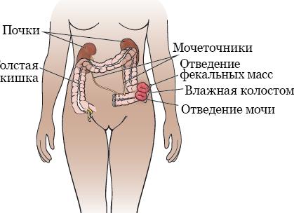 Почему в моче появляется повышенное содержание уратов, как с этим бороться?