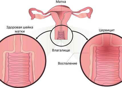 Почему выделения у женщин пахнут чесноком