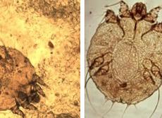 Что такое педикулез, почему он возникает, и как его лечить?