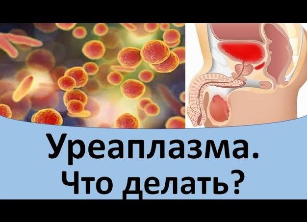 Можно ли вылечить уреаплазму навсегда, каким образом