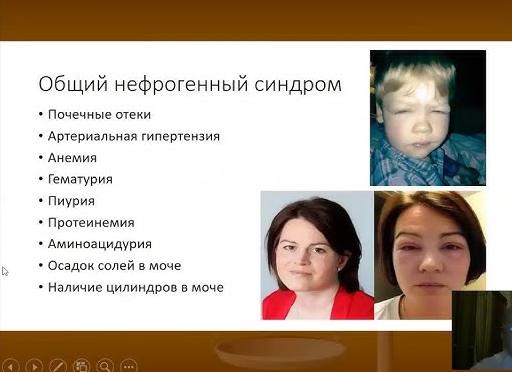 Что означает появление цилиндров в моче, сколько их в норме, почему они повышаются?