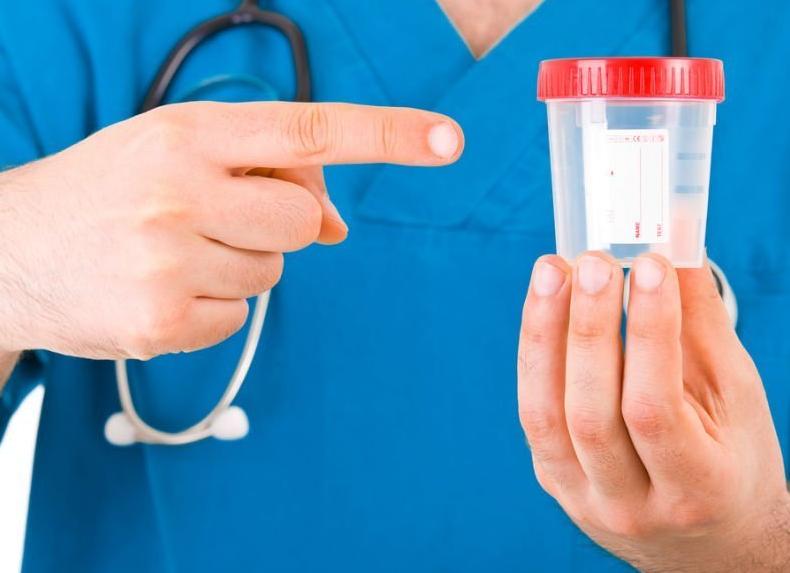 Как правильно собрать суточный анализ мочи на белок, как он расшифровывается?