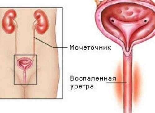 Почему моча бывает с запахом аммиака?