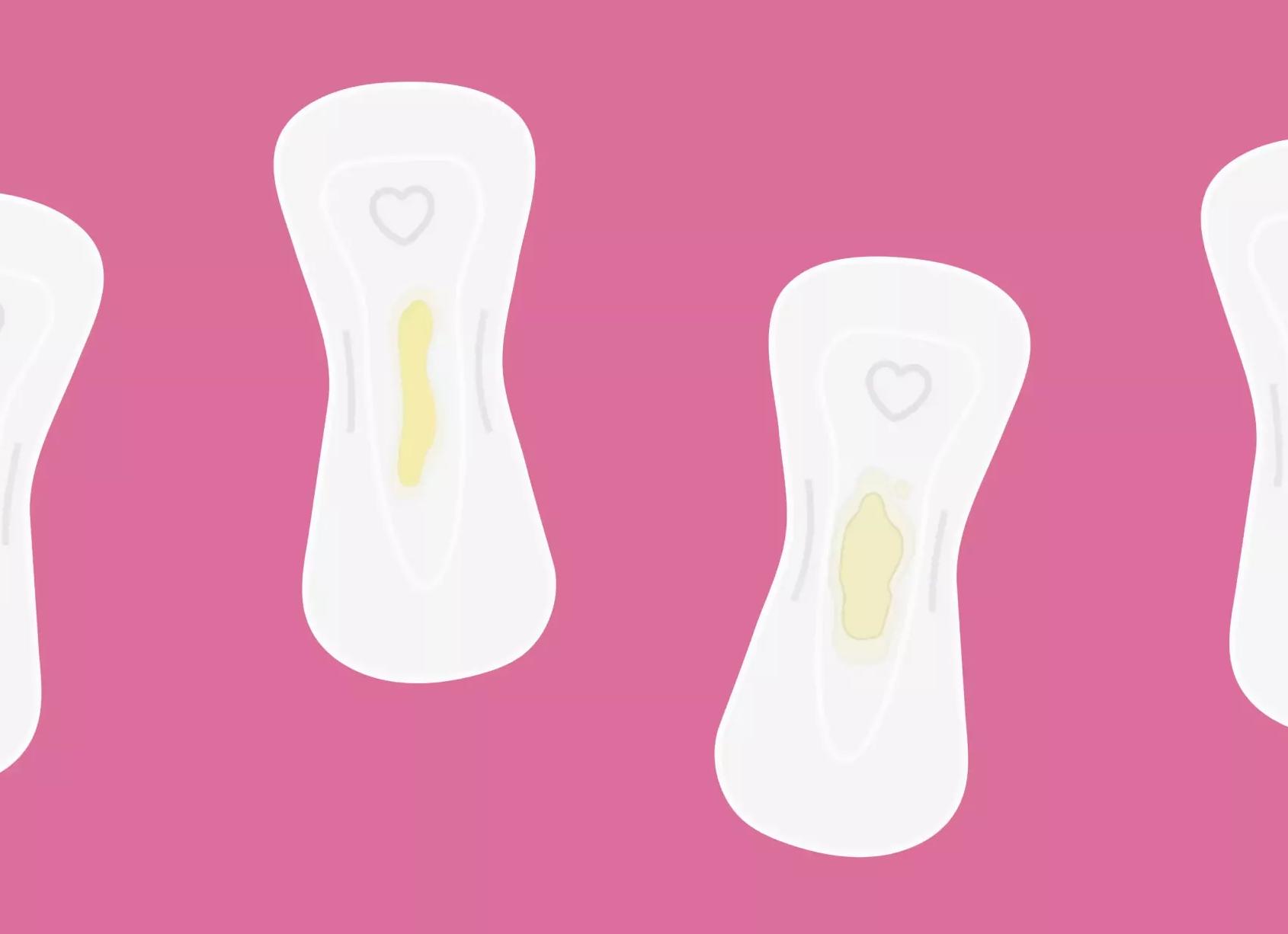 Какие выделения могут быть перед месячными в норме и при патологии?