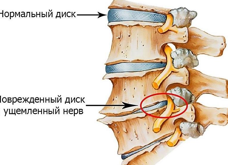 К какому врачу обратиться при подозрении на сифилис?