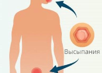 На сколько опасен сифилис, какая тяжесть последствий у заболевания?