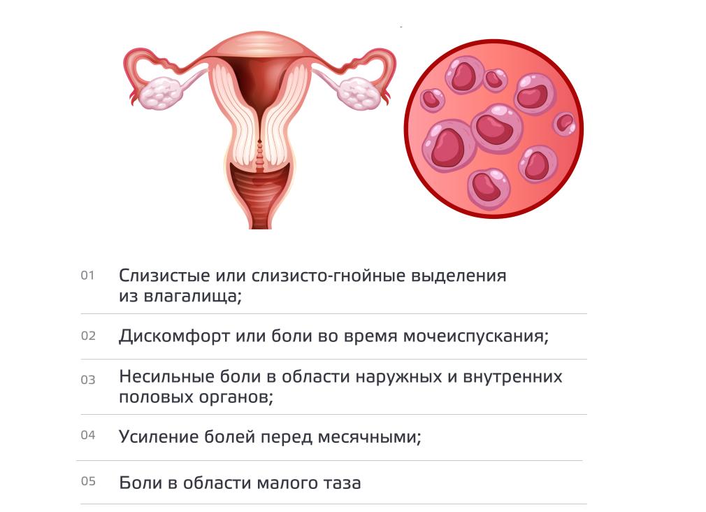 Хламидиоз — что это такое, как он лечится?