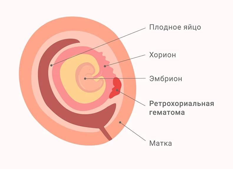 Причины бежевых выделений при беременности