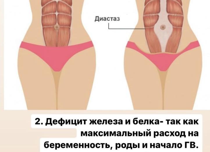 Как протекает беременность и роды после перенесенного сифилиса?