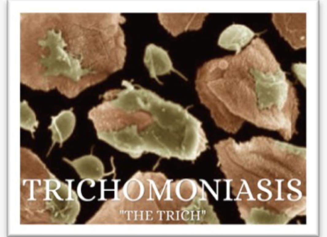 Трихомониаз — кто является возбудителем инфекции