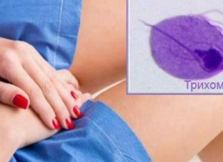 Трихомониаз — что это за заболевание, в чем его опасность